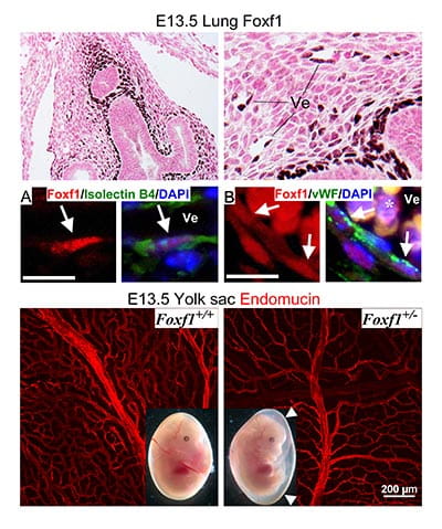 Foxf1 transcription factor is expressed in pulmonary mesenchyme and endothelial cells. Foxf1 deficiency disrupts formation of the capillary network in mouse embryos.